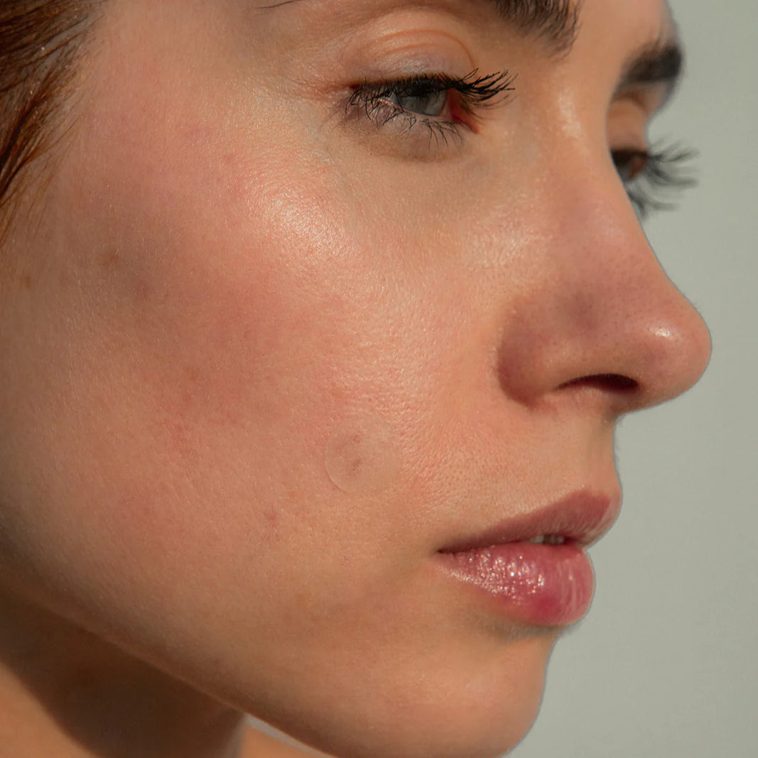 Clarify Pimple Patch™ - Blemish Patches with Hydrocolloid